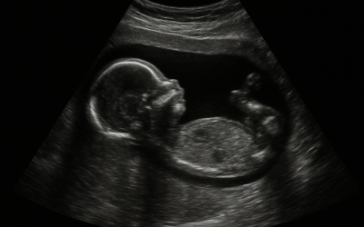 Échographie 3d : fille ou garçon, comment obtenir une visualisation fiable ?