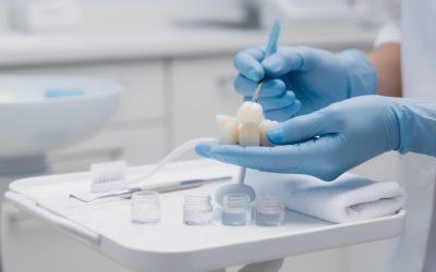 Comment blanchir des couronnes en céramique : méthode et conseils pratiques